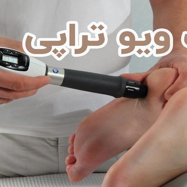 شاک ویو